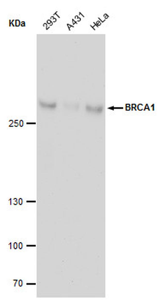 BRCA1 Antibody in Western Blot (WB)