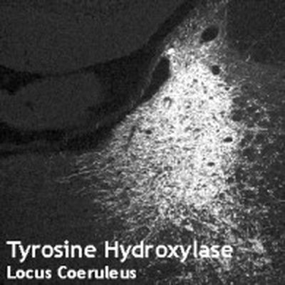 Tyrosine Hydroxylase Antibody in Immunohistochemistry (IHC)