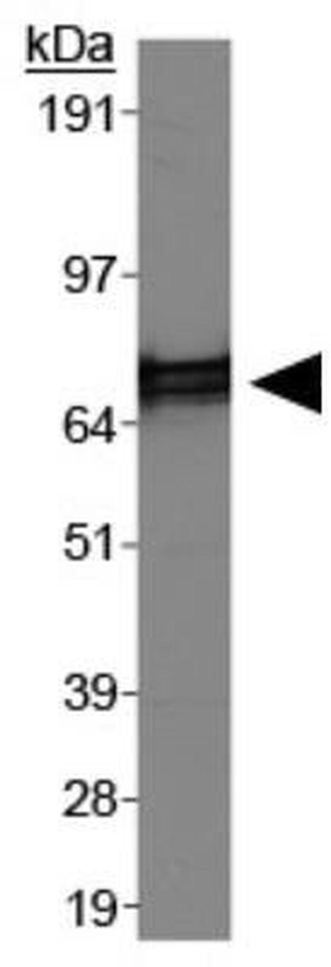 hnRNP M Antibody in Western Blot (WB)