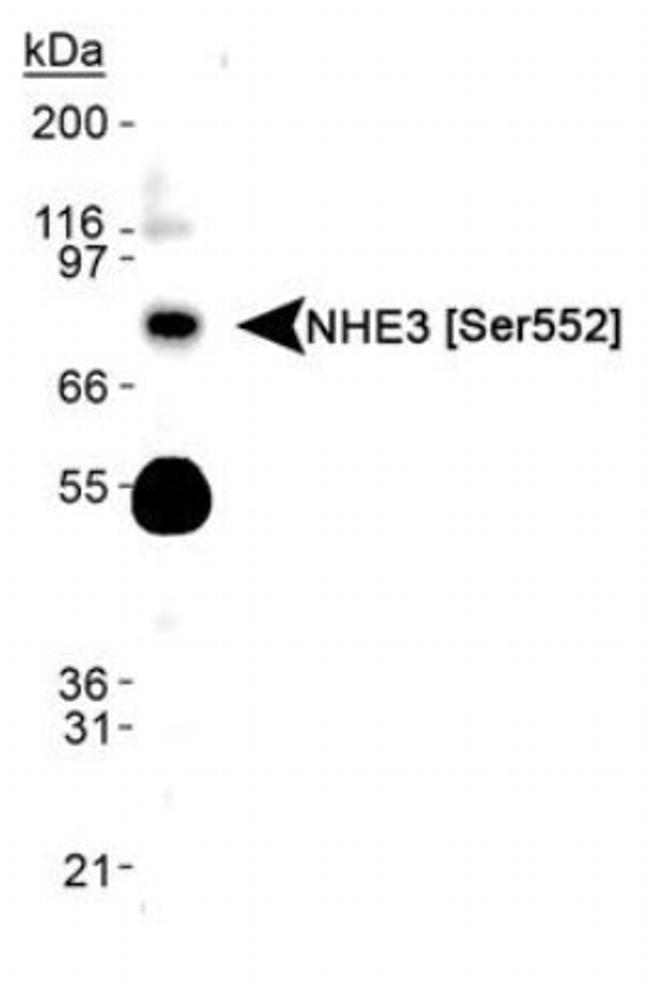 Phospho-NHE3 (Ser522) Antibody in Western Blot (WB)