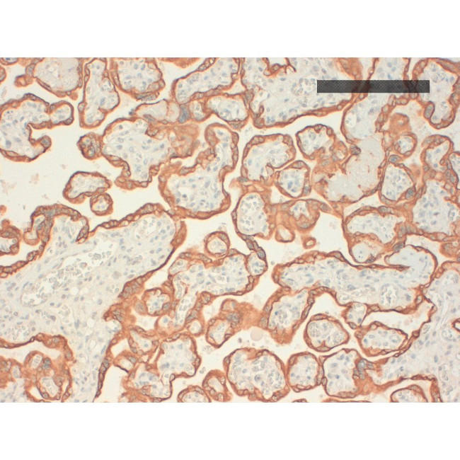 Cytokeratin Pan Type I Antibody in Immunohistochemistry (Paraffin) (IHC (P))
