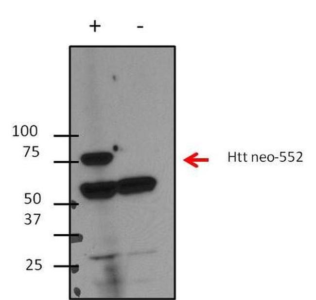 Huntingtin Antibody in Western Blot (WB)