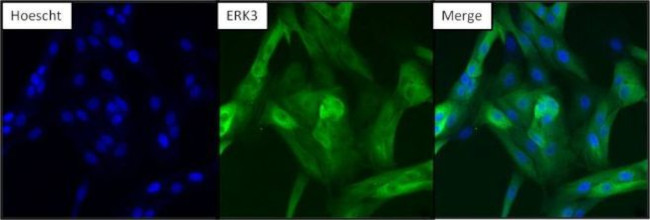 ERK3 Antibody in Immunocytochemistry (ICC/IF)