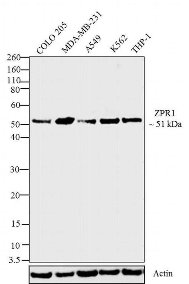 ZPR1 Antibody in Western Blot (WB)