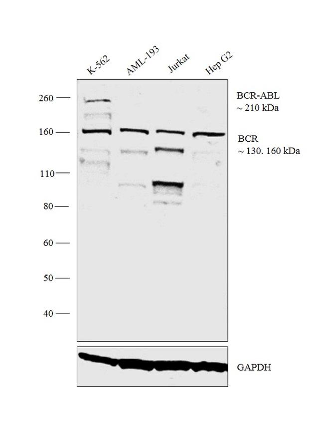BCR-ABL Antibody in Western Blot (WB)