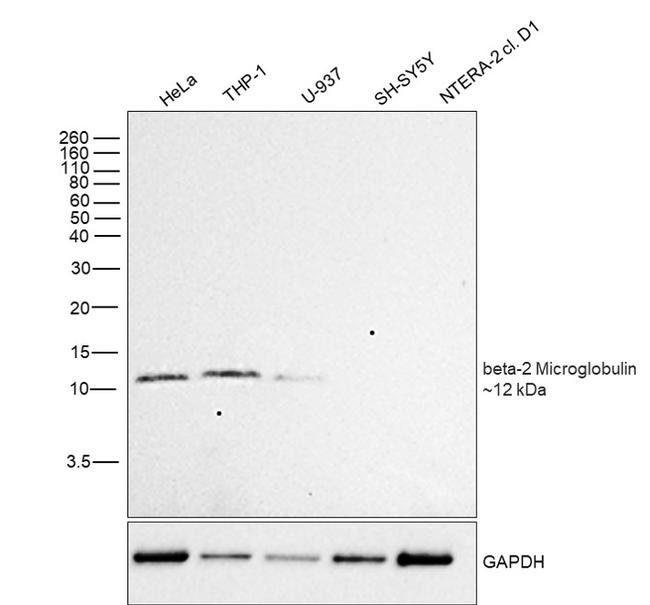 beta-2 Microglobulin Antibody in Western Blot (WB)