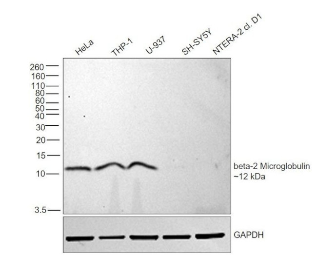 beta-2 Microglobulin Antibody