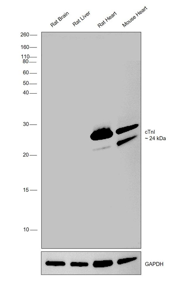 Cardiac Troponin I Monoclonal Antibody (M155) (MA1-20121)