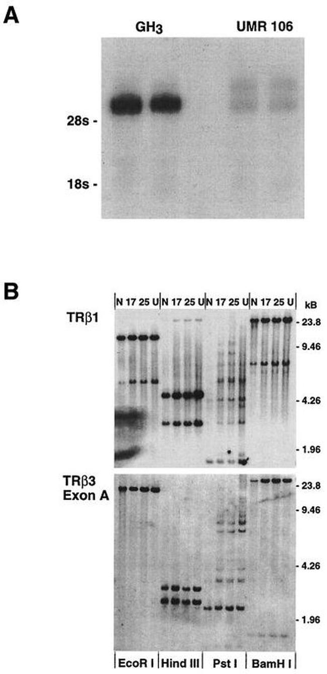 THRA/THRB Antibody in Western Blot (WB)
