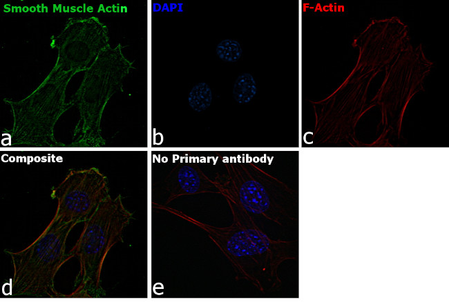 Alpha-Smooth Muscle Actin Antibody in Immunocytochemistry (ICC/IF)