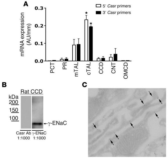 Calcium Sensing Receptor Antibody in Western Blot, Immunocytochemistry (WB, ICC/IF)