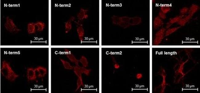 Calcium Sensing Receptor Antibody in Immunocytochemistry (ICC/IF)
