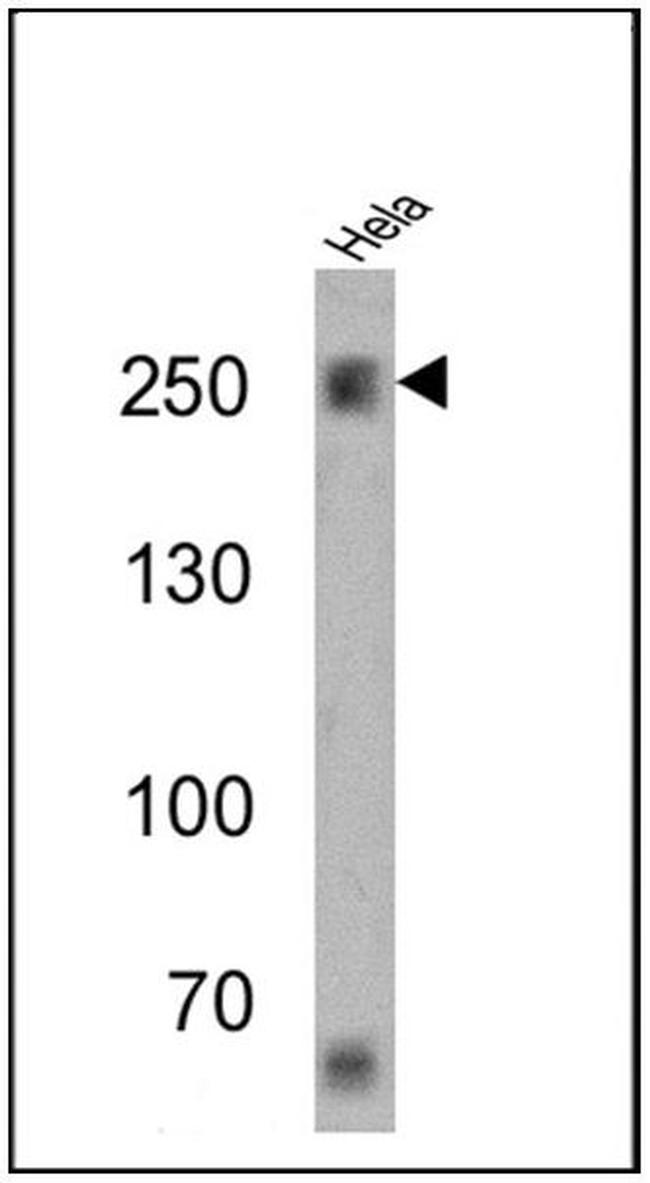 SPTBN1 Antibody in Western Blot (WB)