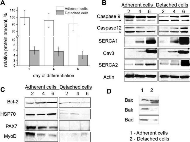 SERCA1 ATPase Antibody in Western Blot (WB)