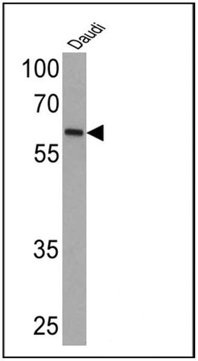Human IgA (Heavy chain) Secondary Antibody in Western Blot (WB)