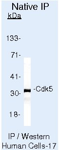 CDK5 Antibody in Immunoprecipitation (IP)