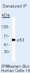 p53 Antibody in Immunoprecipitation (IP)