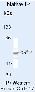 p57 Kip2 Antibody in Immunoprecipitation (IP)