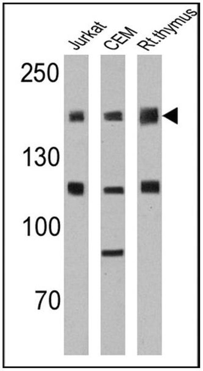 CD45RO Antibody in Western Blot (WB)