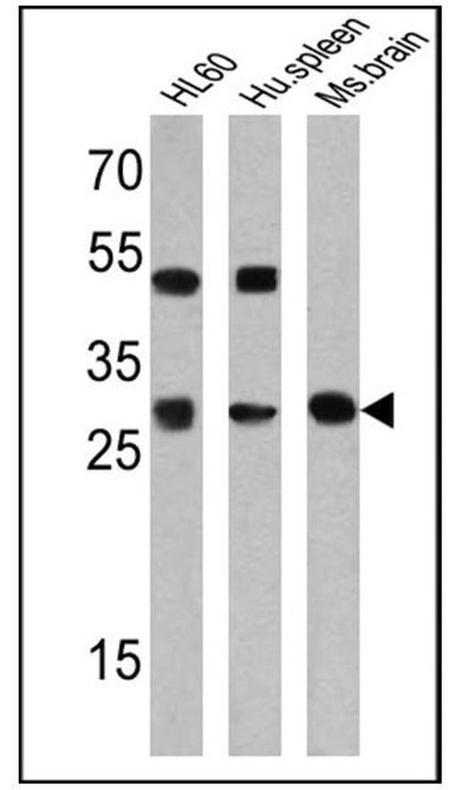 PR3 Antibody in Western Blot (WB)