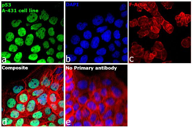 p53 Antibody in Immunocytochemistry (ICC/IF)