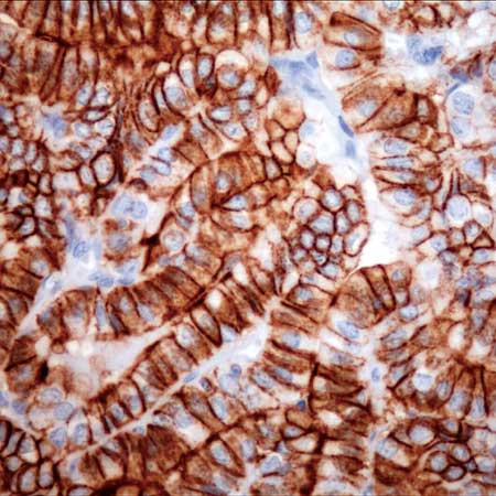 Thyroid Cancer Marker Antibody in Immunohistochemistry (Paraffin) (IHC (P))
