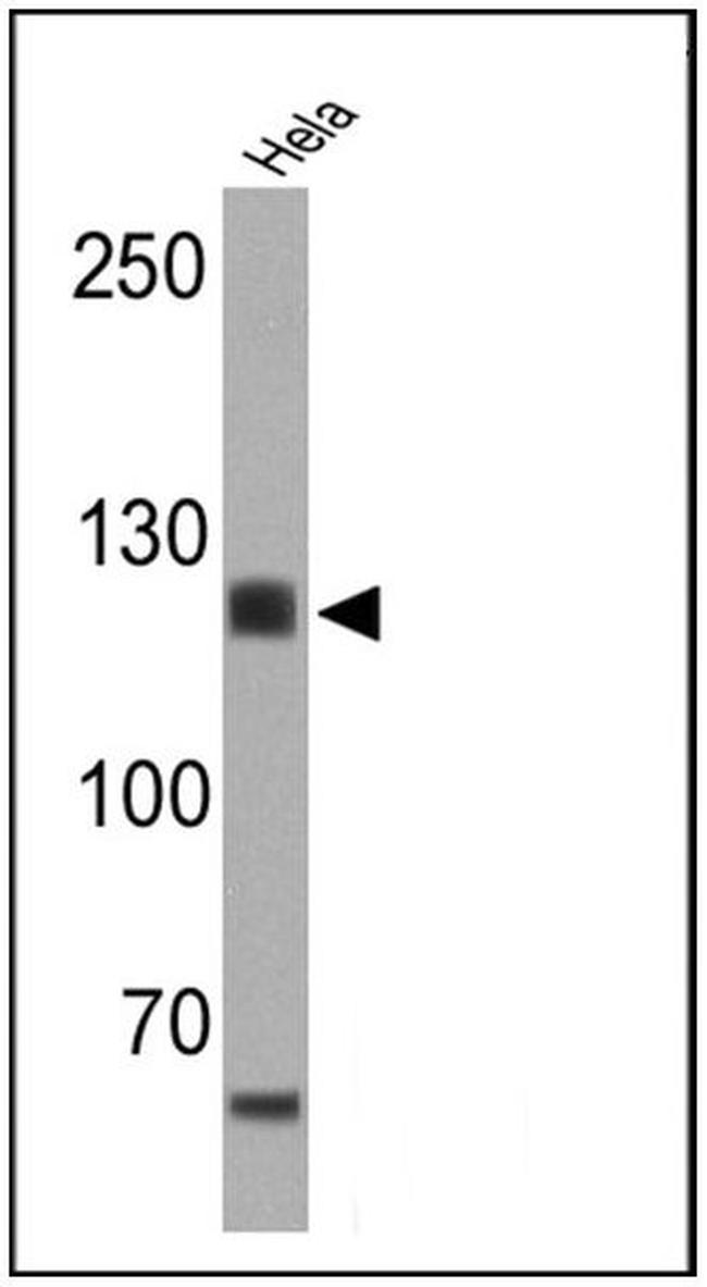CD30 Antibody in Western Blot (WB)