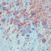 MAP2 Antibody in Immunohistochemistry (Paraffin) (IHC (P))