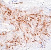RPSA Antibody in Immunohistochemistry (Paraffin) (IHC (P))