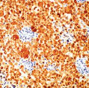S100 Antibody in Immunohistochemistry (Paraffin) (IHC (P))