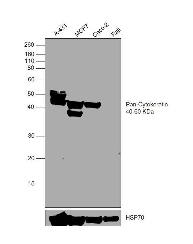 Cytokeratin Pan Type I/II Antibody in Western Blot (WB)
