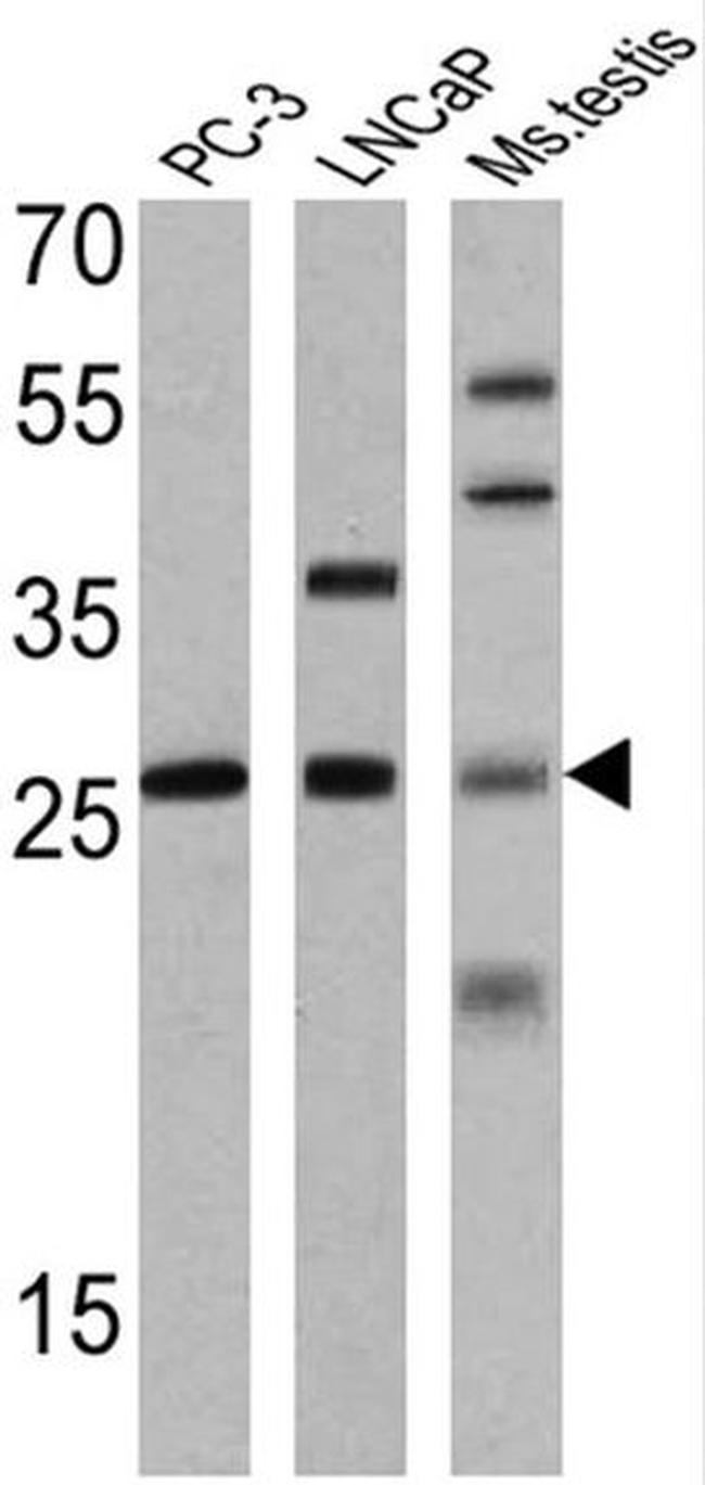 Histone H1 Antibody in Western Blot (WB)