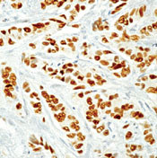 Estrogen Receptor alpha Antibody in Immunohistochemistry (Paraffin) (IHC (P))