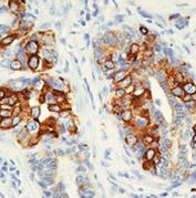Cytokeratin 8 Antibody in Immunohistochemistry (Paraffin) (IHC (P))