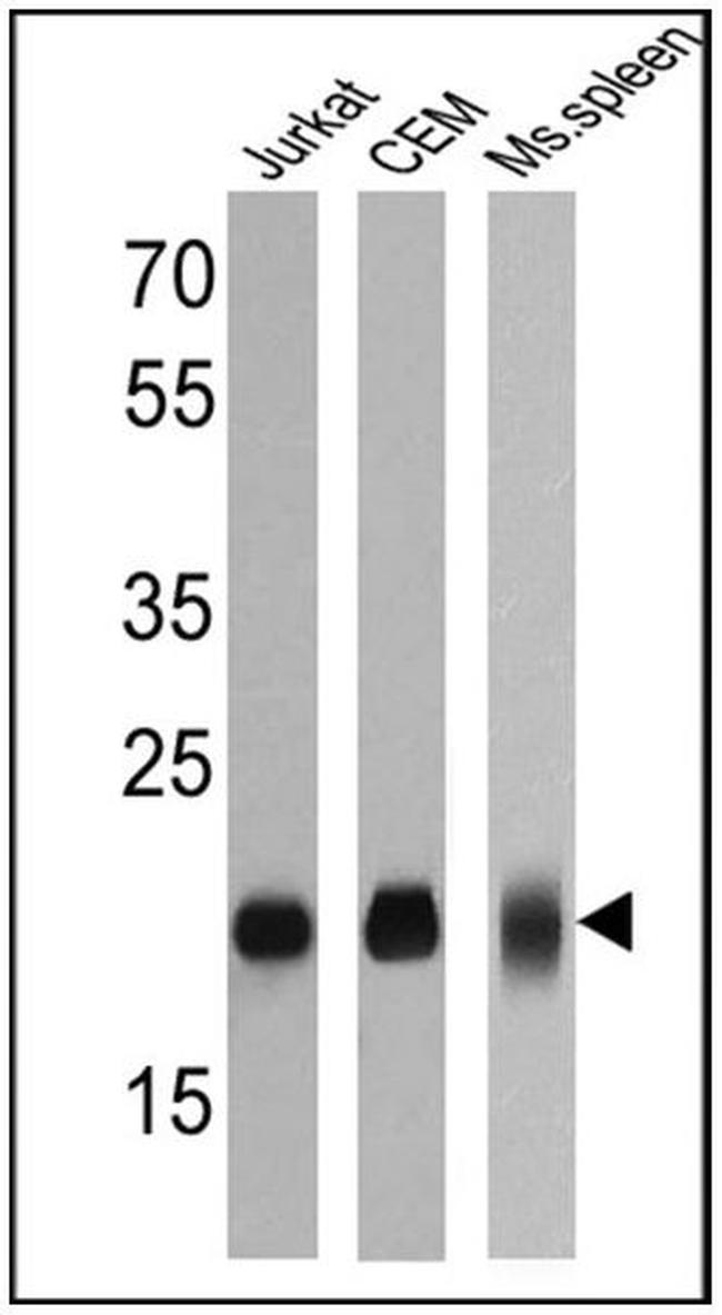 CD3e Antibody in Western Blot (WB)