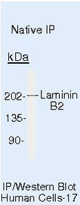 Laminin beta-2/gamma-1 Antibody in Immunoprecipitation (IP)