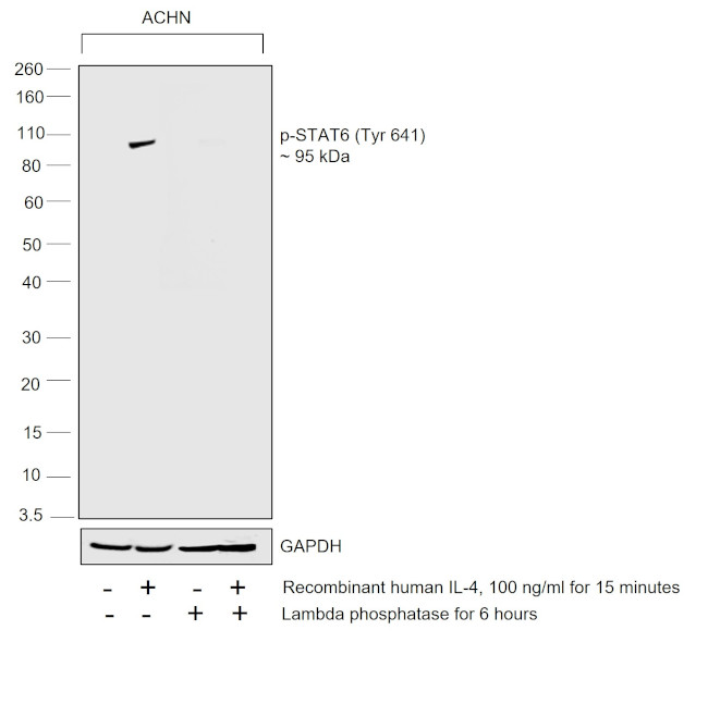 Phospho-STAT6 (Tyr641) Antibody
