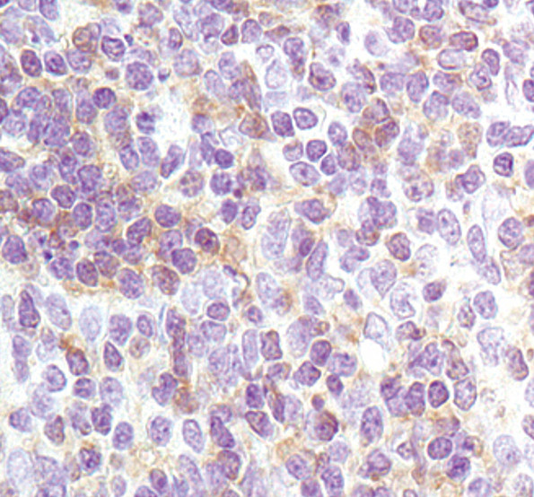 Lyn Antibody in Immunohistochemistry (Paraffin) (IHC (P))