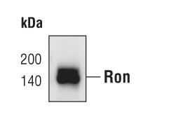 RON Antibody in Western Blot (WB)