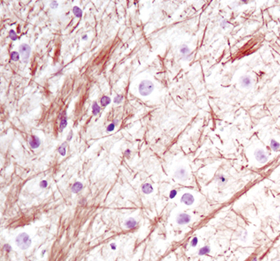 NEFL Antibody in Immunohistochemistry (Paraffin) (IHC (P))