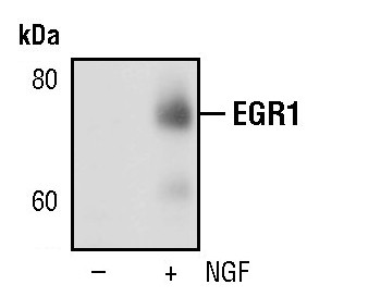 EGR1 Antibody in Western Blot (WB)