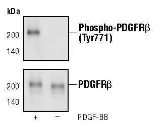Phospho-PDGFRB (Tyr771) Antibody in Western Blot (WB)