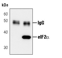 Phospho-EIF2S1 (Ser52) Antibody in Immunoprecipitation (IP)