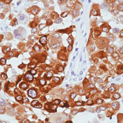 Melan-A Antibody in Immunohistochemistry (Paraffin) (IHC (P))