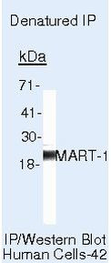 Melan-A Antibody in Immunoprecipitation (IP)