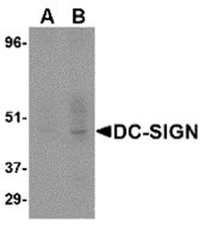DC-SIGN Antibody in Western Blot (WB)
