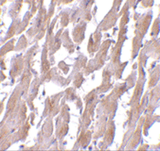 MyD88 Antibody in Immunohistochemistry (IHC)