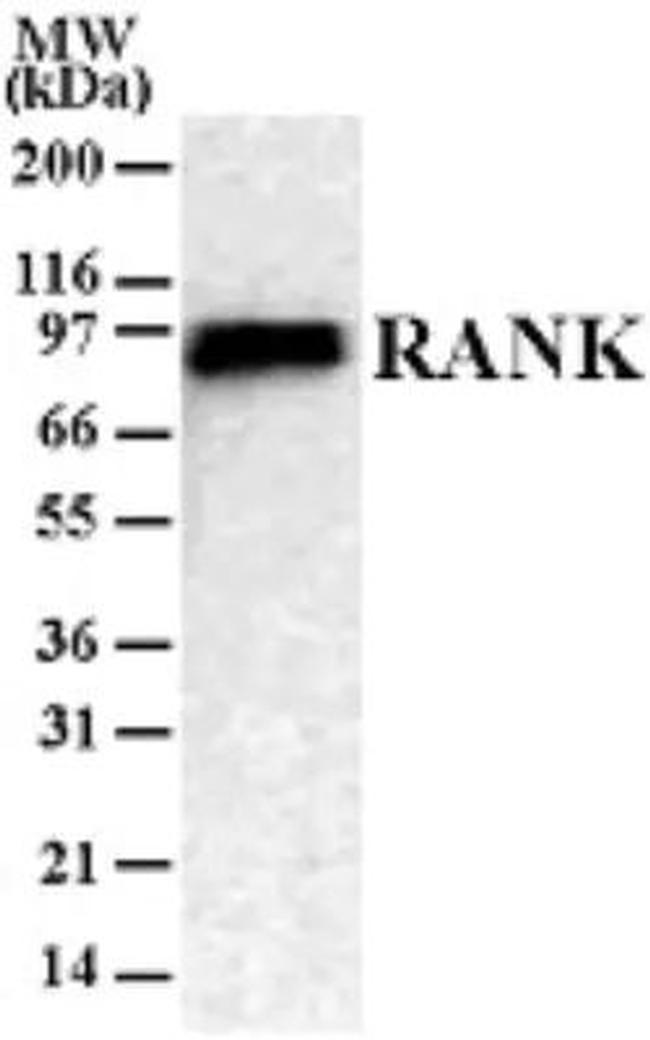 RANK Antibody in Western Blot (WB)