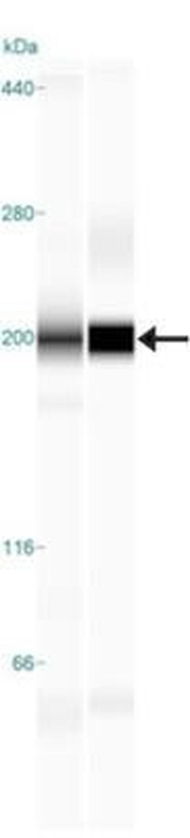 TLR8 Antibody in Western Blot (WB)