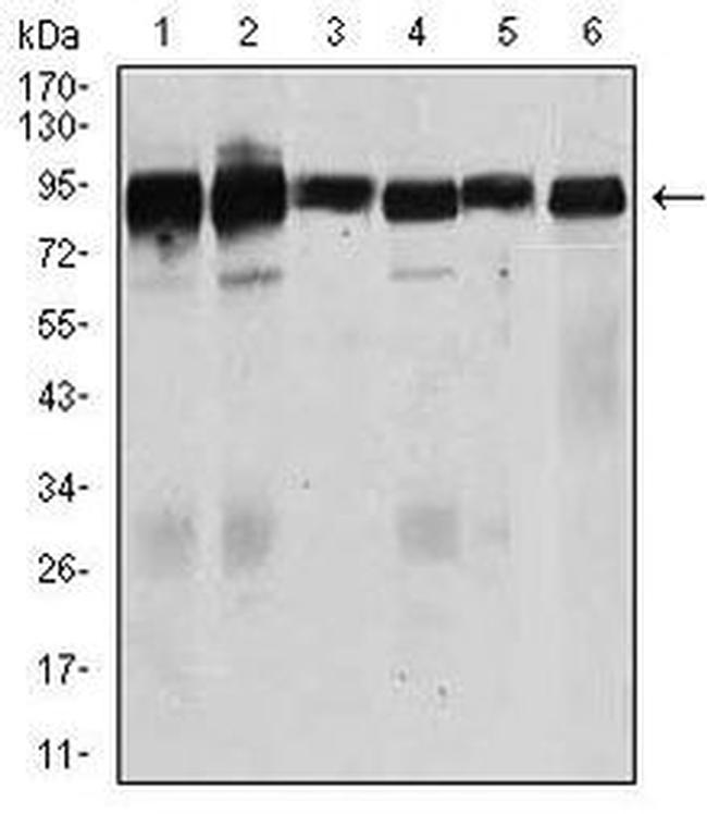 TGFBR3 Antibody in Western Blot (WB)